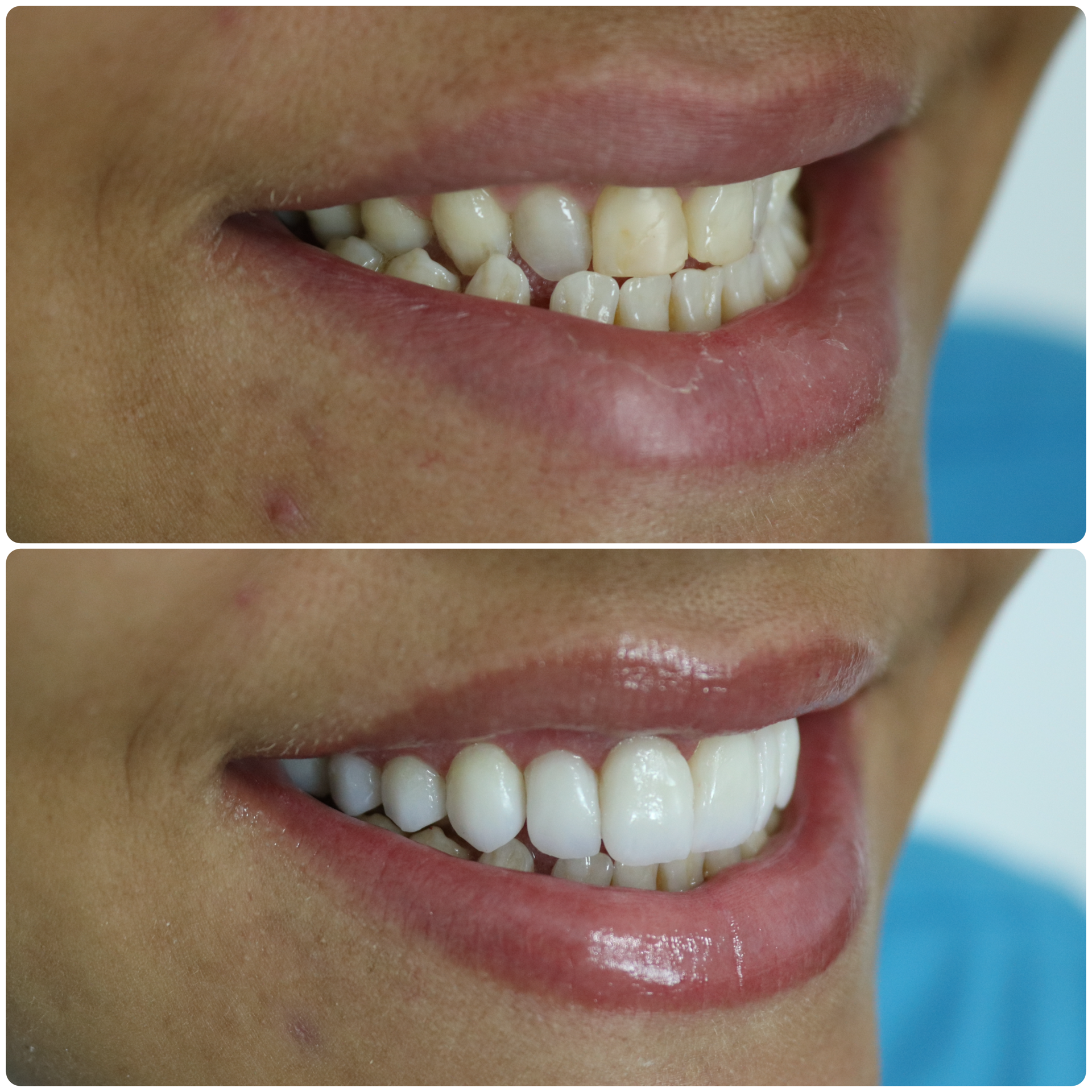 7A247450-C52E-4D6B-B1FC-F92F17C4AF87