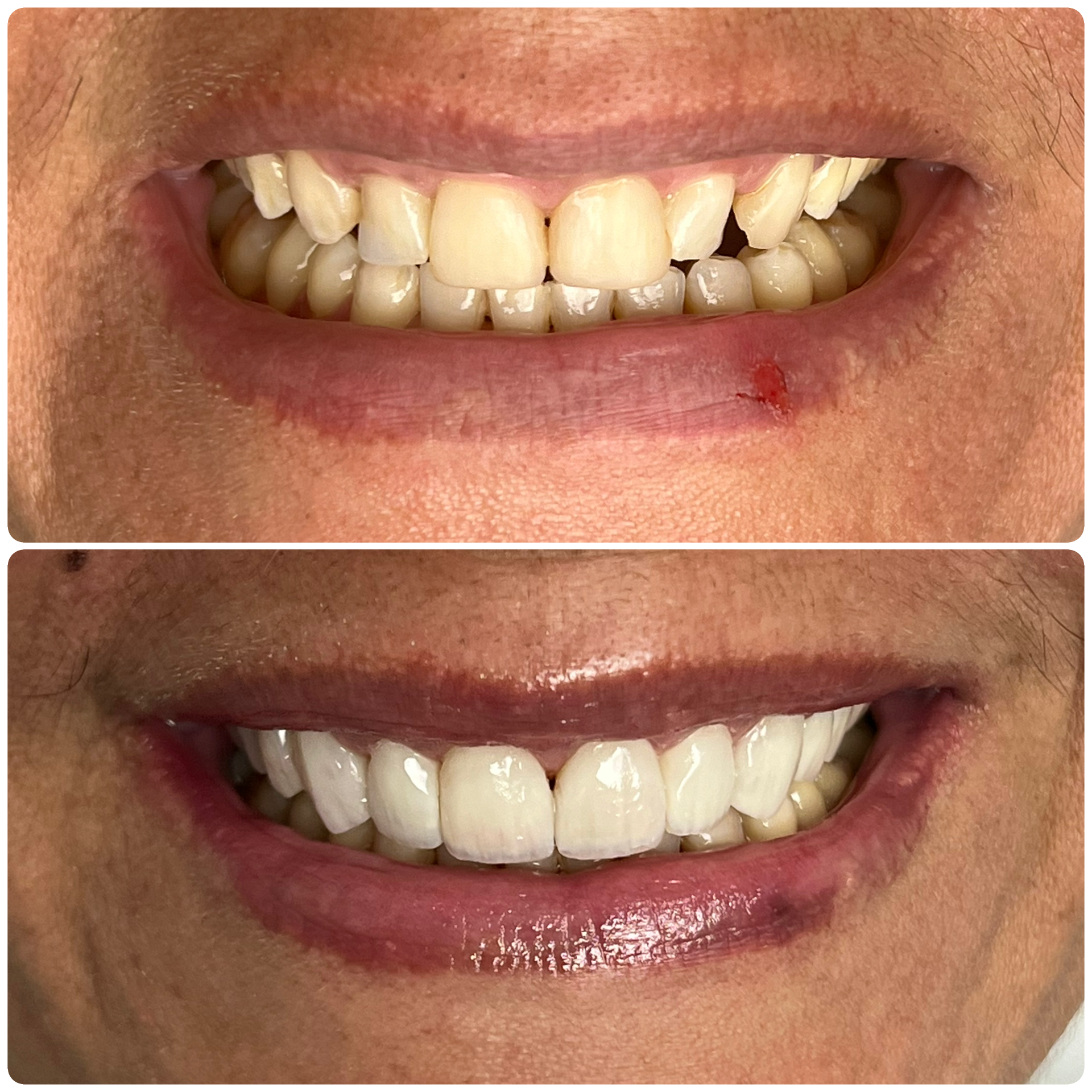 D0F9A68F-7C14-49B6-9CA0-33DEEF499F4A