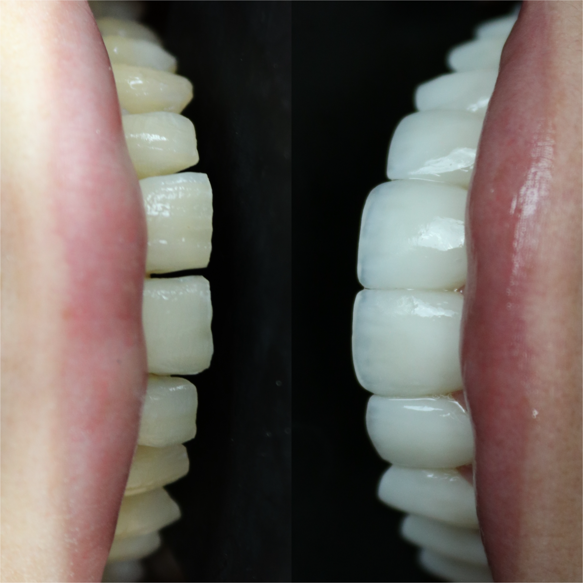 D37CE303-3705-489B-8B64-243961A8176C