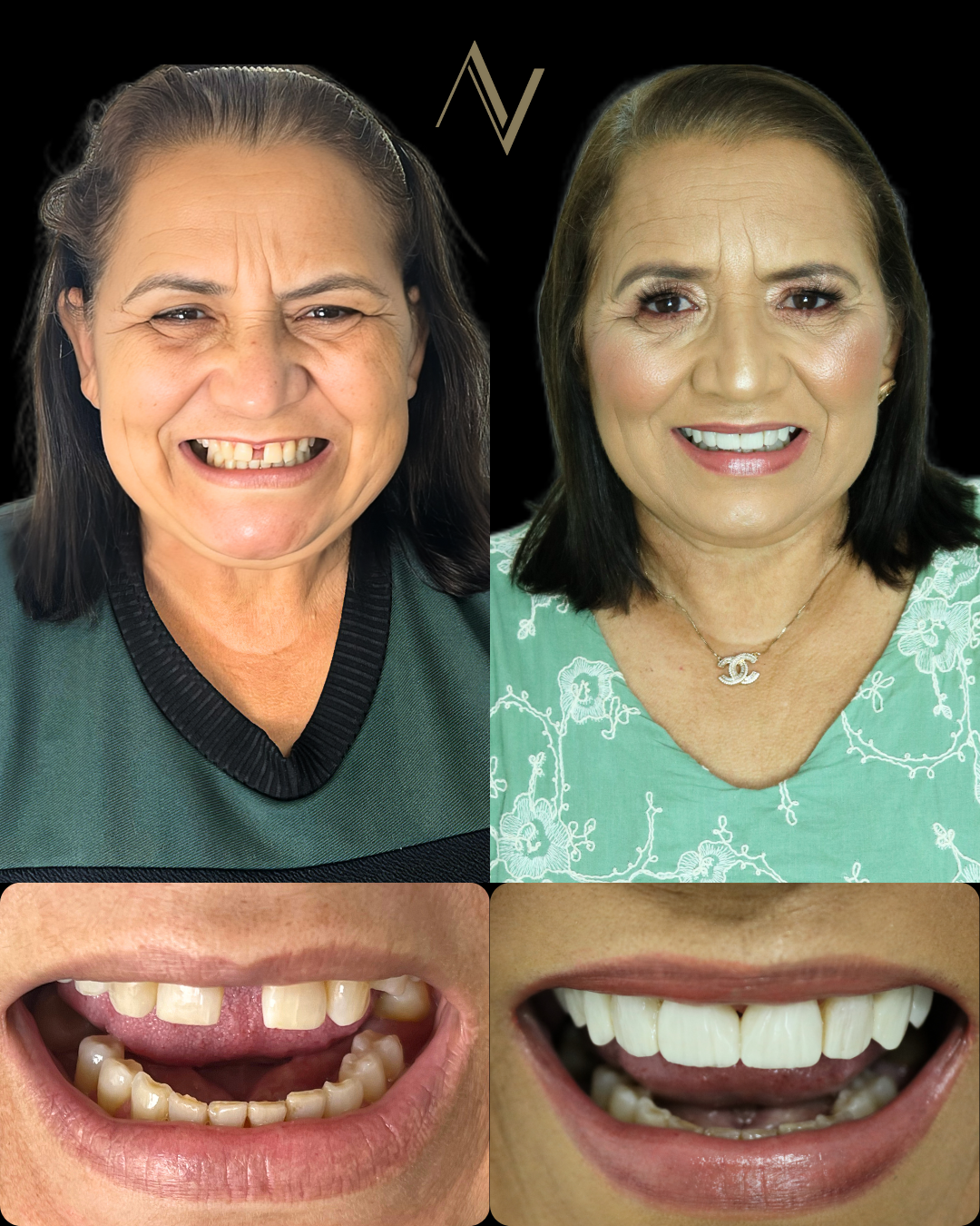 Facetas em.zip - 2